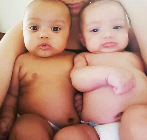 Meet the twin baby girls no one believes are sisters