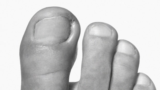 Five Rules for Your Feet
