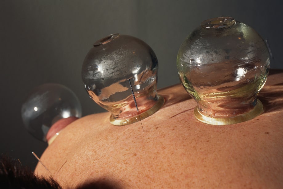 Weird Recovery Methods that Actually Work