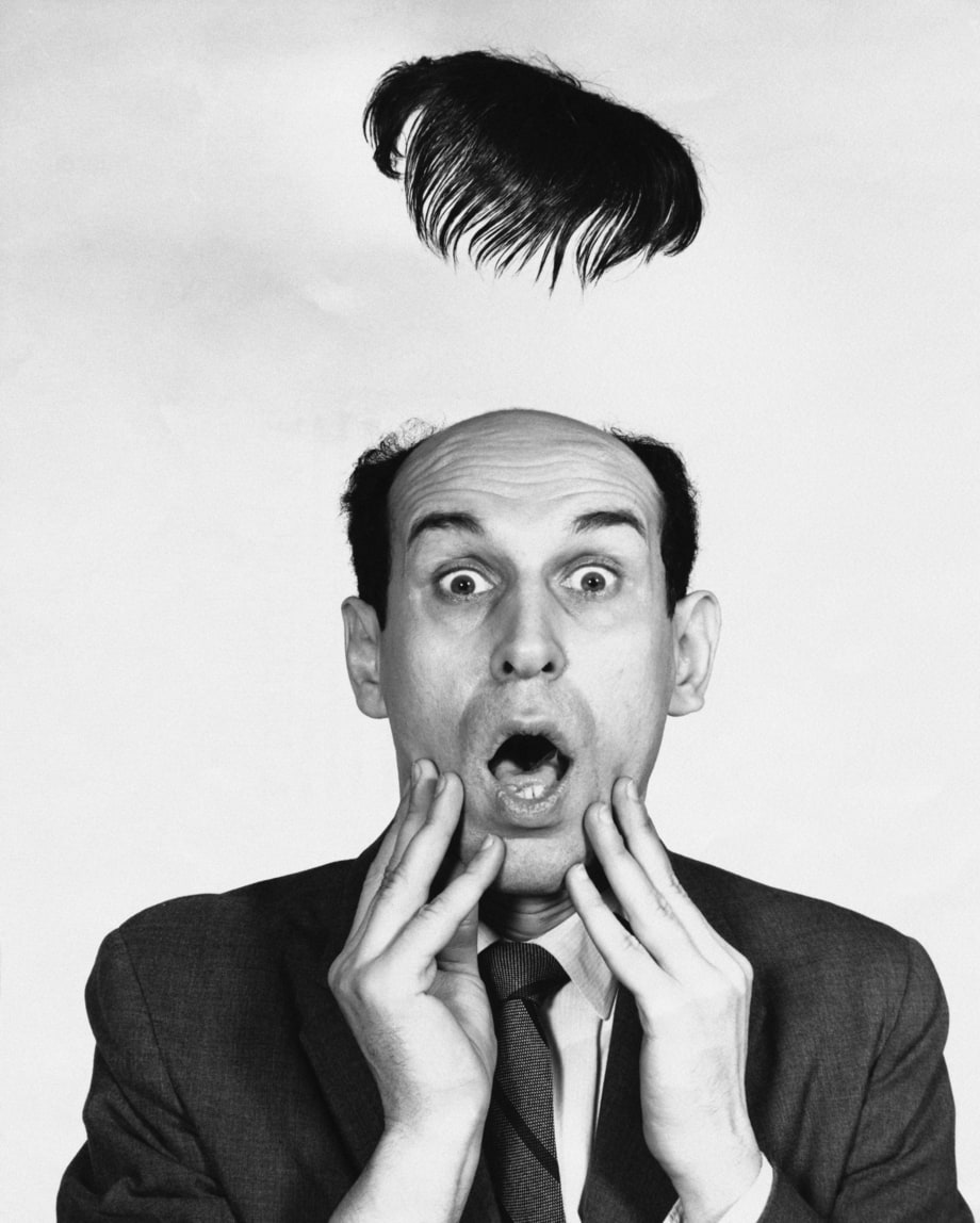 7 Biggest Grooming Mistakes Balding Men Make