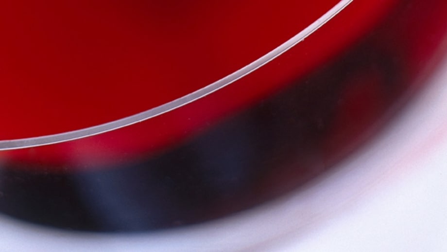 Cardiovascular Health