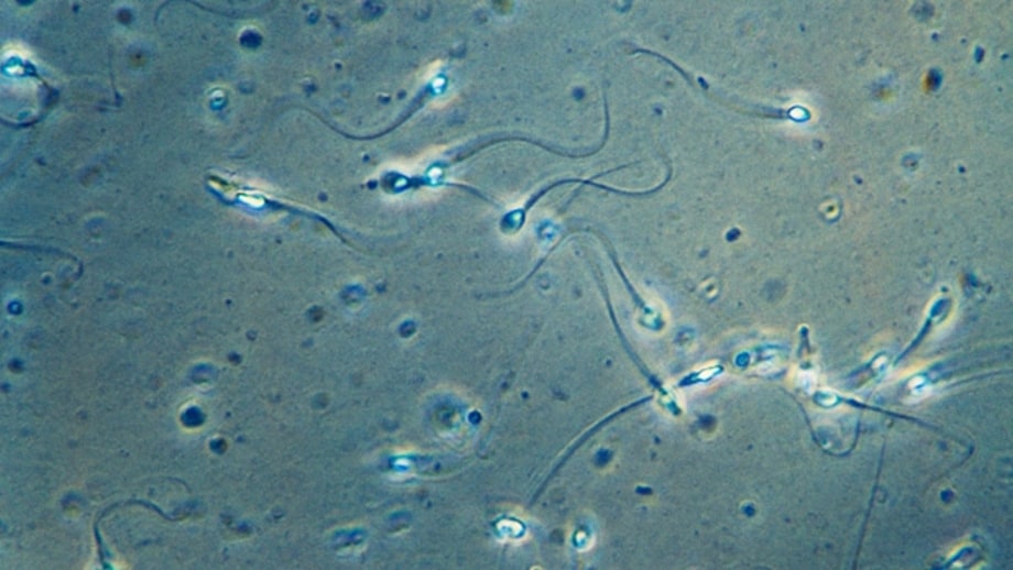 Consider Assisted Reproductive Technology.