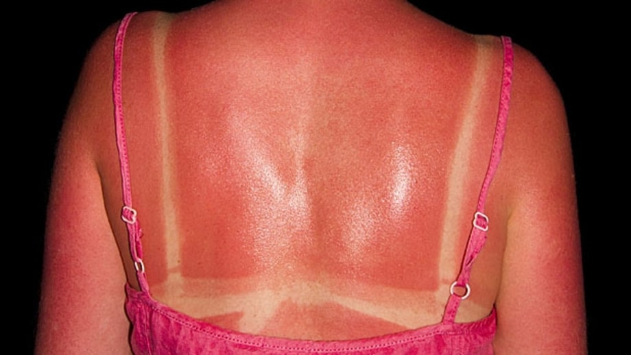 Get Out of the Sun