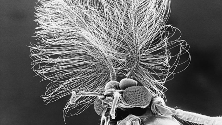 Chikungunya