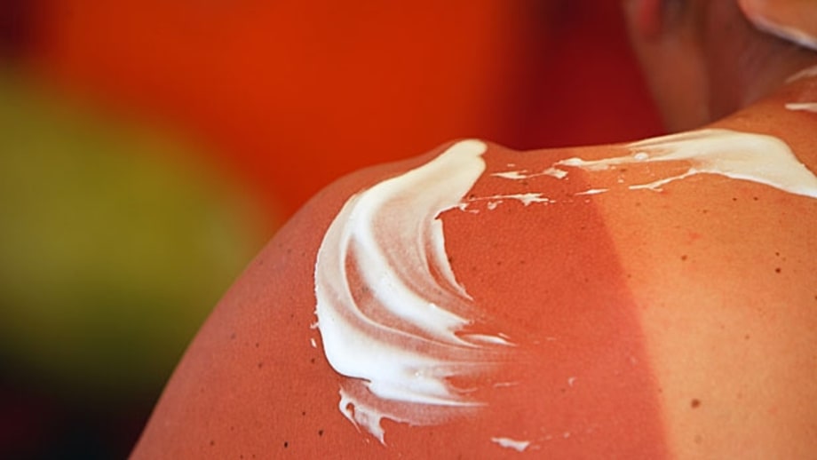 Use Lots of Lotion