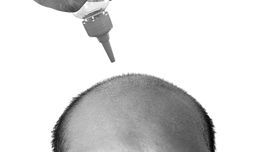 Rogaine (Minoxidil) Works: Fact