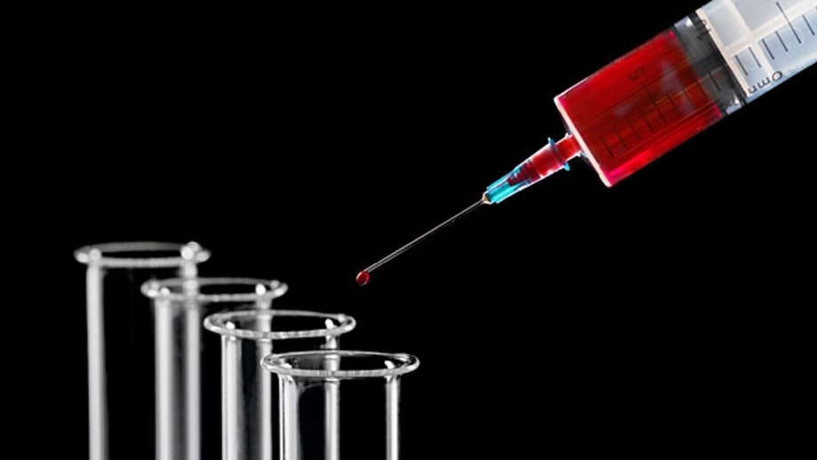 Get your blood tested.