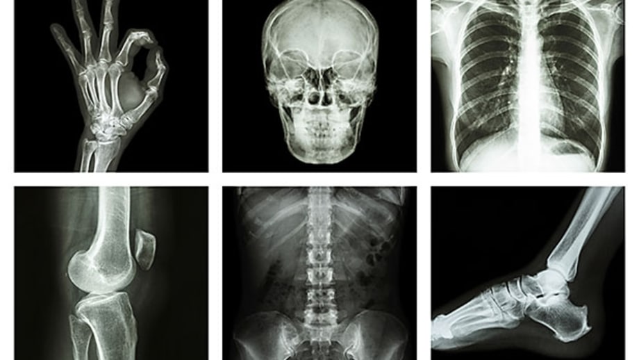 The 10 Best Ways to Keep Bones Healthy