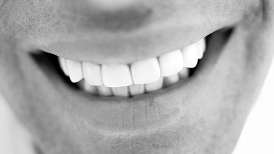 Best Ways to Whiten Teeth