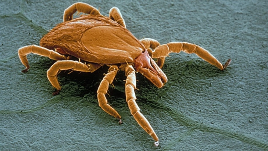 Wear insect-repelling clothes