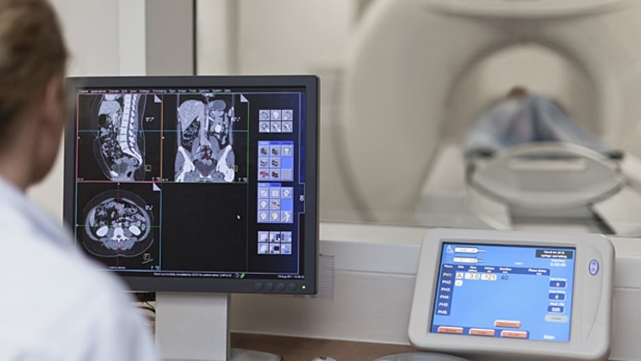 When to get a second opinion on CT scans.