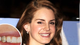 PIC: Lana Del Rey Rocks Sparkly Silver Tooth Cap