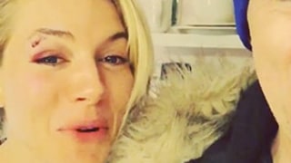 Sienna Miller Has a Black Eye, and Her Cabaret Costar Alan Cumming Teases Her About It: What Happened?