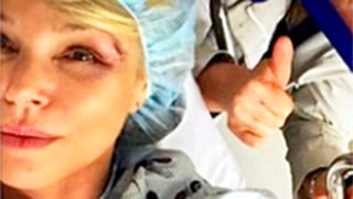Christie Brinkley Nurses a Black Eye After Run-In With a Bird at Parrot Cay: Picture