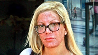 Tori Spelling Leaves Spa With an Especially Red, Splotchy Face: Find Out What Happened!