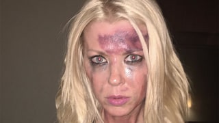 Tara Reid Sparks Concerns After Posting an Instagram Photo of Herself Looking Battered and Bruised: 'This Is What Bullying Looks Like’