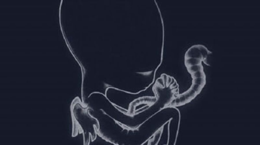 Sigur Ros, 'Ágætis Byrjun'