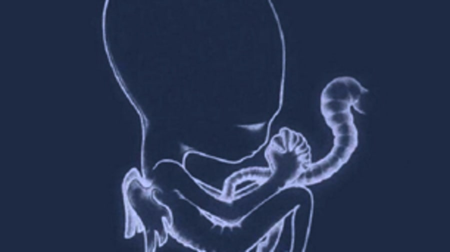 Sigur Rós, 'Ágætis byrjun'