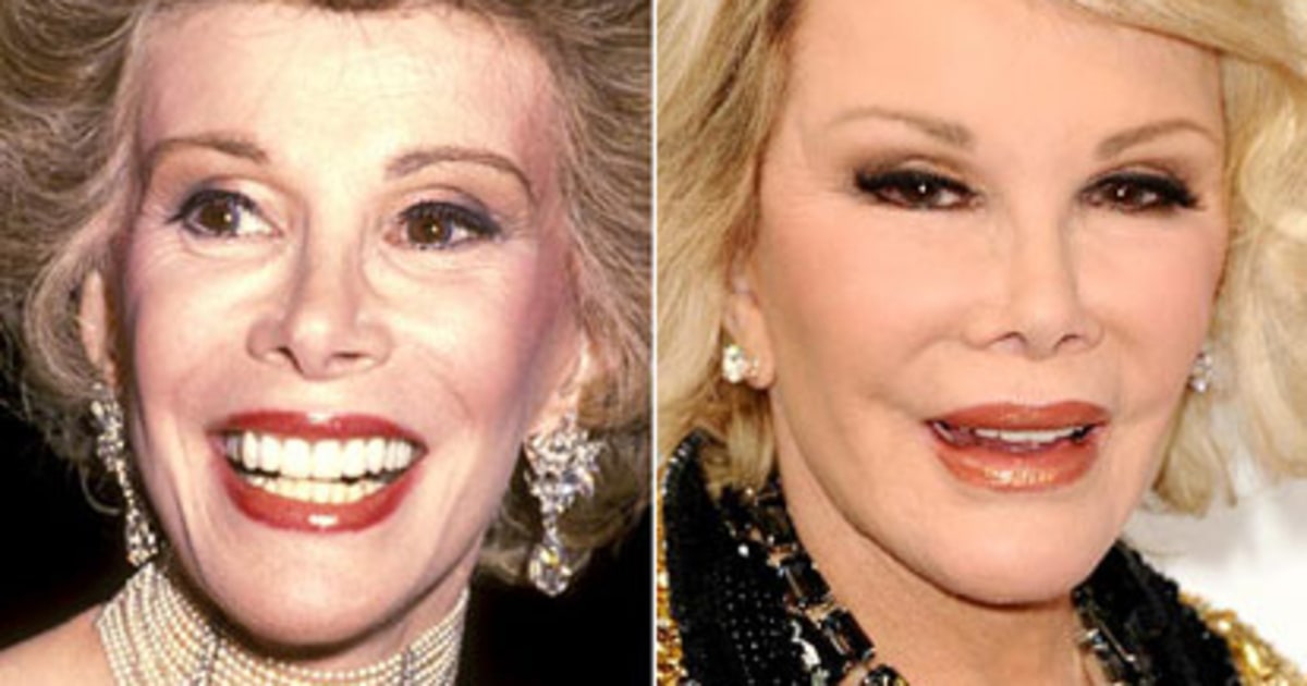 Joan Rivers Celeb Makeovers Before & After Us Weekly