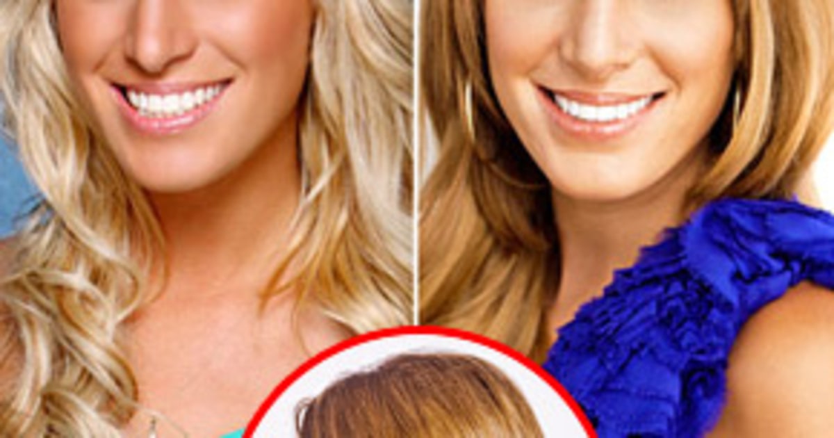 Vienna Girardi Plastic Surgery Before And After Photo vrogue.co