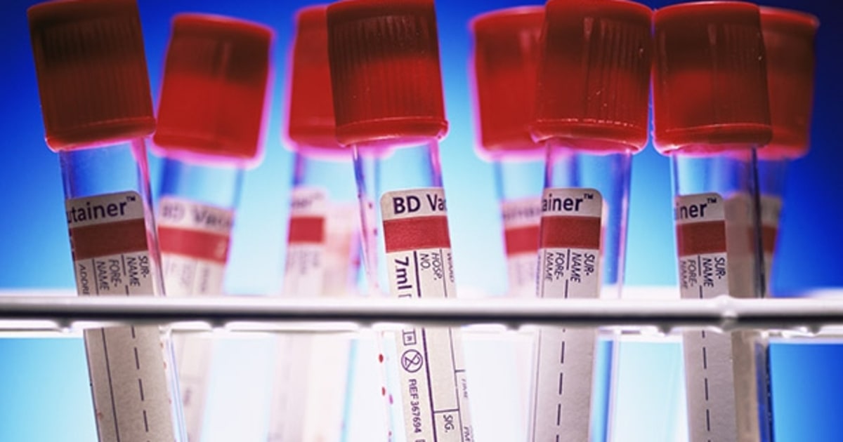 Four Blood and DNA Tests for a Fitter, Stronger You Men's Journal
